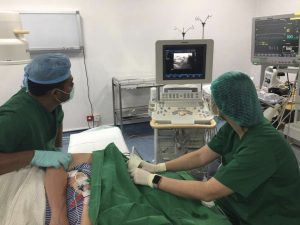 Performing interscalene block for regional anesthesia